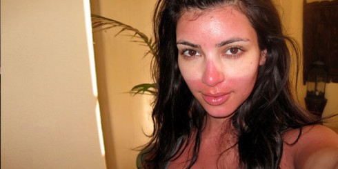 kim-kardashian-sunburn