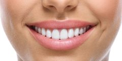 dental implants whitened smile