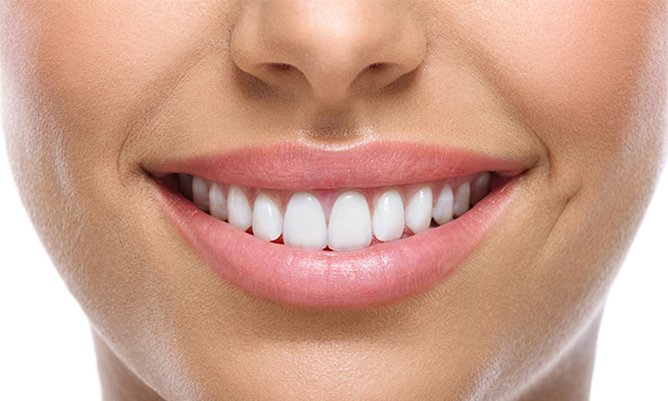 dental implants whitened smile