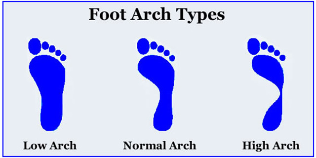 Foot Arch Types Runner Running Shoes